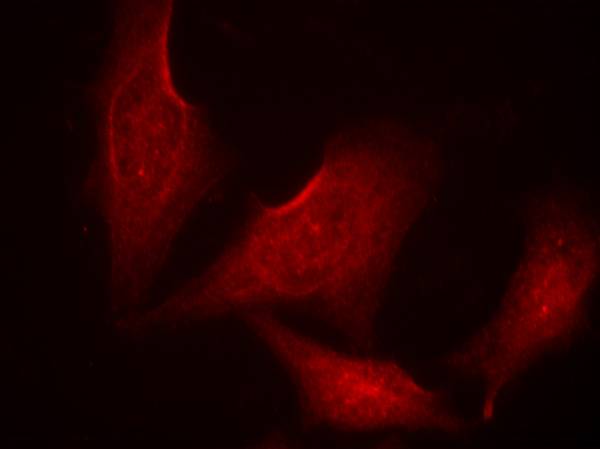 Anti-Phospho-NF-KB p65 (Ser311) Rabbit Polyclonal Antibody