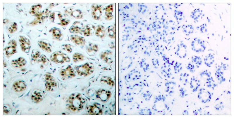 Anti-Phospho-NF-KB p65 (Ser311) Rabbit Polyclonal Antibody