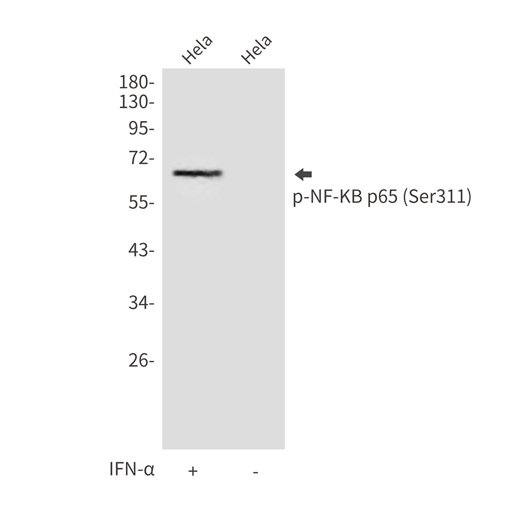 Anti-Phospho-NF-KB p65 (Ser311) Rabbit Polyclonal Antibody