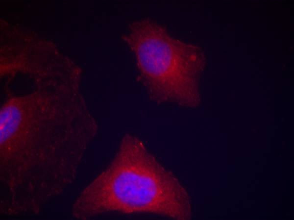 Anti-Phospho-GSK3 (Tyr279/Tyr216) Rabbit Polyclonal Antibody