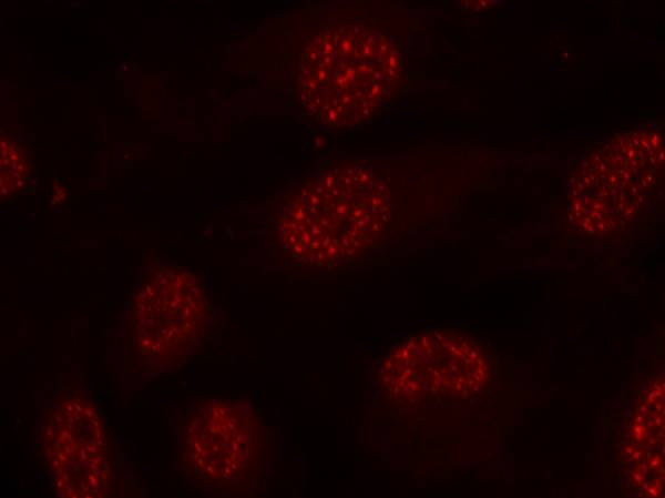 Anti-Phospho-MAPKAPK2 (Thr334) Rabbit Polyclonal Antibody