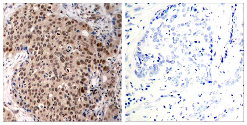 Anti-Phospho-MAPKAPK2 (Thr334) Rabbit Polyclonal Antibody