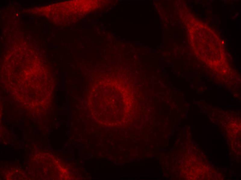 Anti-Phospho-AKT (Tyr315) Rabbit Polyclonal Antibody
