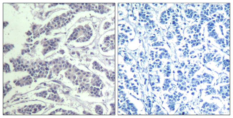 Anti-Phospho-AKT (Tyr315) Rabbit Polyclonal Antibody