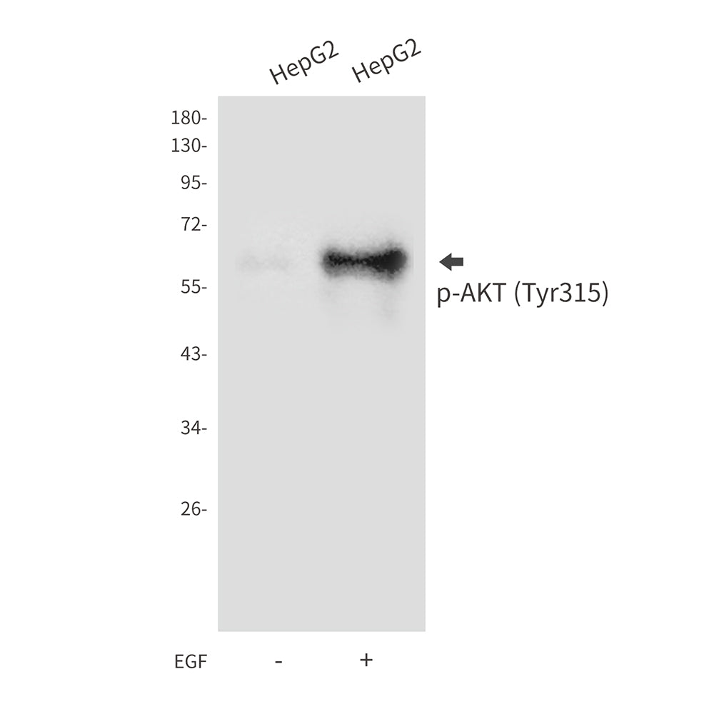 Anti-Phospho-AKT (Tyr315) Rabbit Polyclonal Antibody