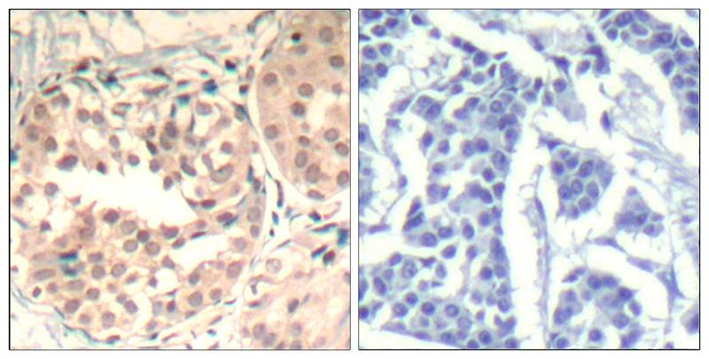 Anti-Phospho-CDK6 (Tyr13) Rabbit Polyclonal Antibody
