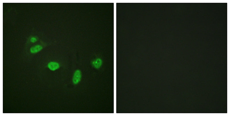 Anti-Phospho-ETS1 (Thr38) Rabbit Polyclonal Antibody