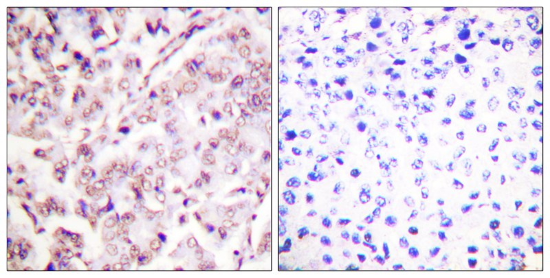 Anti-Phospho-ETS1 (Thr38) Rabbit Polyclonal Antibody