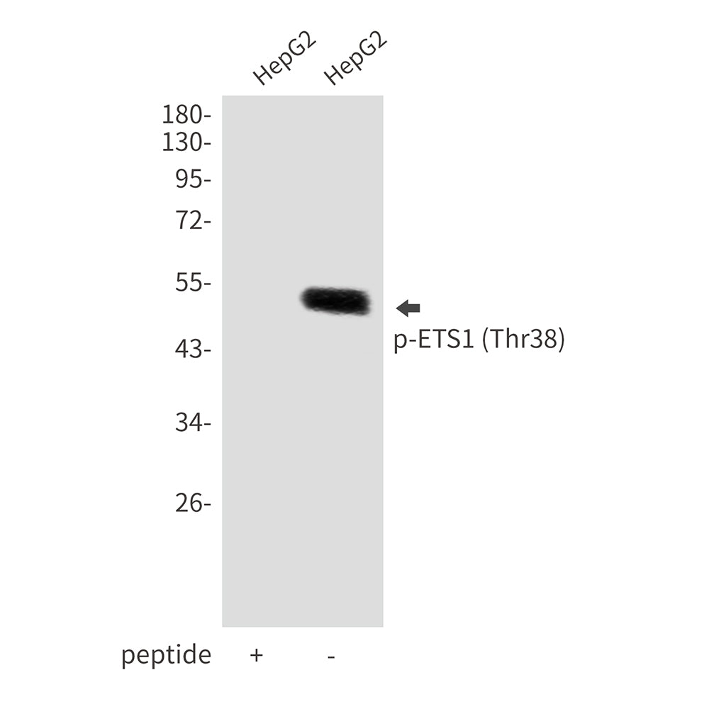 Anti-Phospho-ETS1 (Thr38) Rabbit Polyclonal Antibody