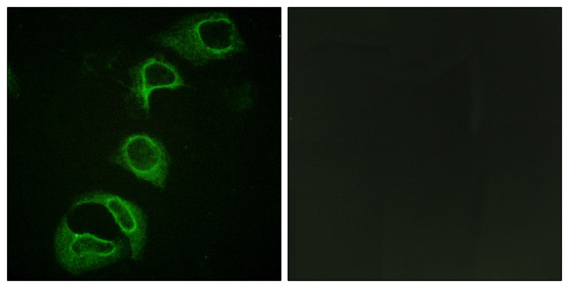 Anti-Phospho-ALK (Tyr1604) Rabbit Polyclonal Antibody