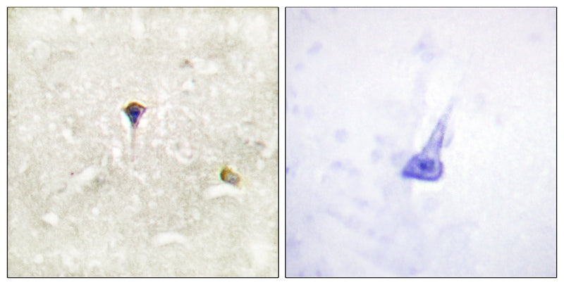 Anti-Phospho-ALK (Tyr1604) Rabbit Polyclonal Antibody