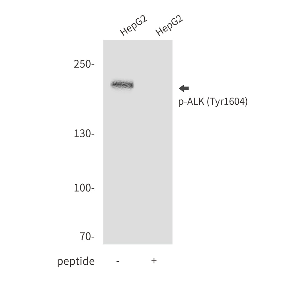 Anti-Phospho-ALK (Tyr1604) Rabbit Polyclonal Antibody
