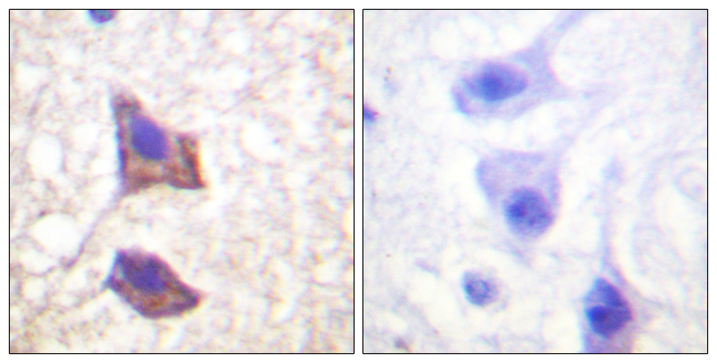Anti-CD130 Rabbit Polyclonal Antibody
