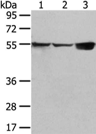 Anti-UGT1A10 Rabbit Polyclonal Antibody