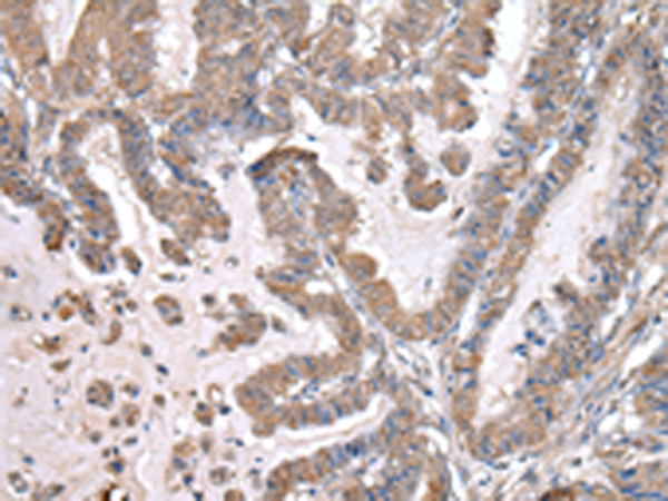 Anti-WWP1 Rabbit Polyclonal Antibody