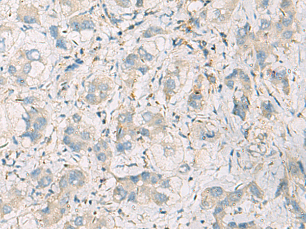 Anti-CMTM6 Rabbit Polyclonal Antibody