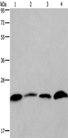 Anti-CMTM6 Rabbit Polyclonal Antibody