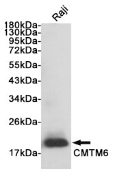 Anti-CMTM6 Rabbit Polyclonal Antibody