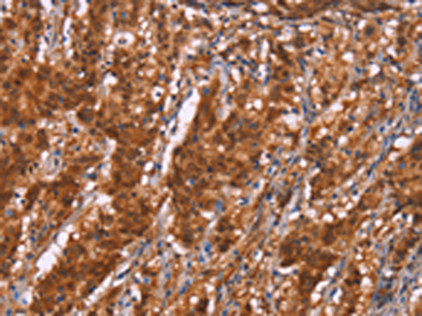 Anti-BRK1 Rabbit Polyclonal Antibody