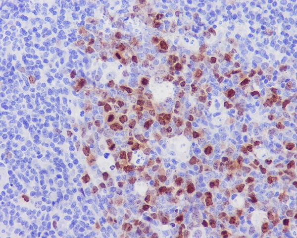 Anti-Aurora B Rabbit Polyclonal Antibody