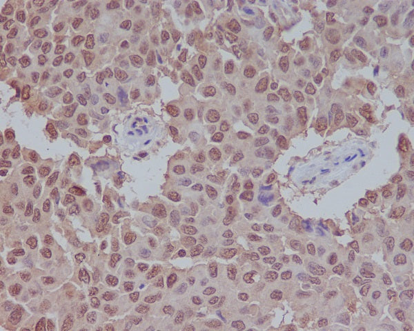 Anti-SUMO1 Rabbit Polyclonal Antibody