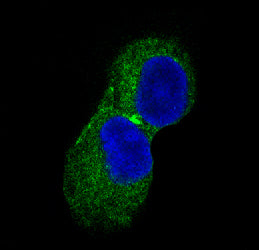 Anti-CaMKII Rabbit Polyclonal Antibody