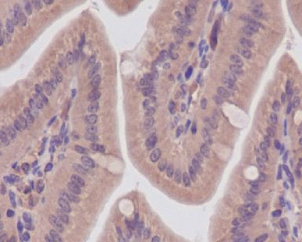 Anti-CaMKII Rabbit Polyclonal Antibody