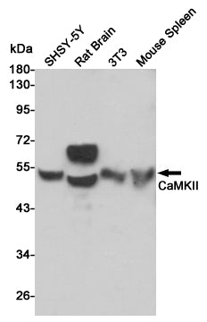 Anti-CaMKII Rabbit Polyclonal Antibody