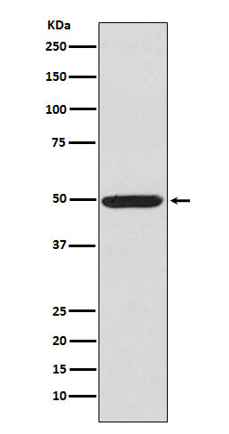 Anti-Phospho-PKA RII alpha (Ser99) Rabbit Polyclonal Antibody