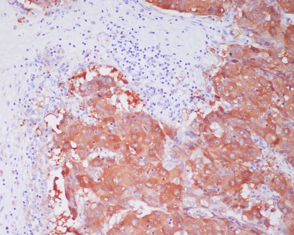 Anti-ALDH1A1 Rabbit Polyclonal Antibody