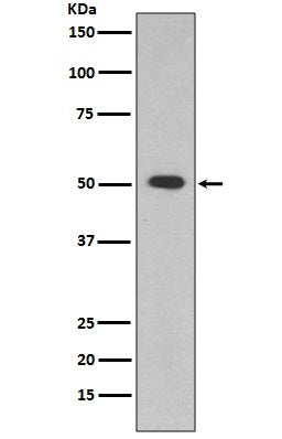 Anti-ALDH1A1 Rabbit Polyclonal Antibody