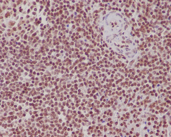 Anti-FUBP1 Rabbit Polyclonal Antibody