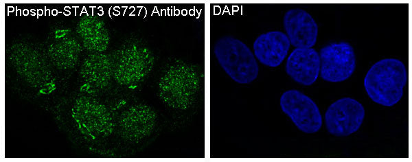 Anti-Phospho-STAT3 (Ser727) Rabbit Polyclonal Antibody