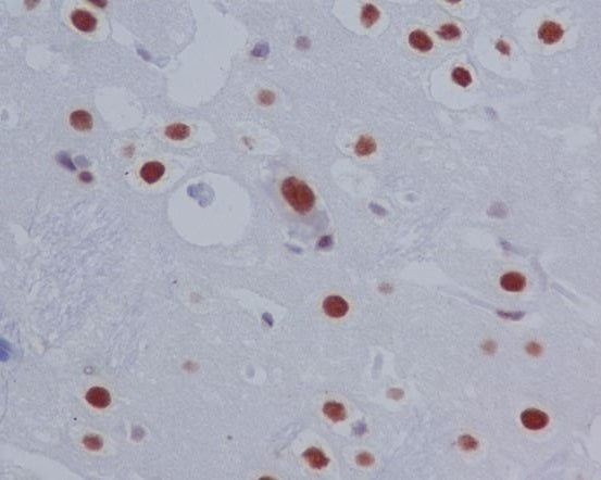 Anti-Phospho-STAT3 (Ser727) Rabbit Polyclonal Antibody