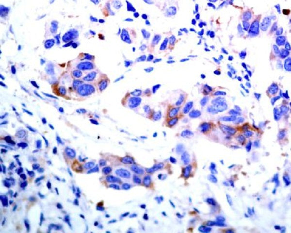 Anti-ASK1 Rabbit Polyclonal Antibody
