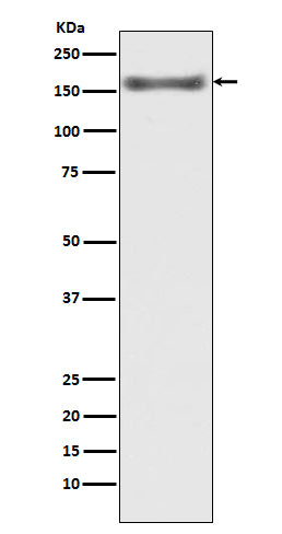 Anti-ASK1 Rabbit Polyclonal Antibody