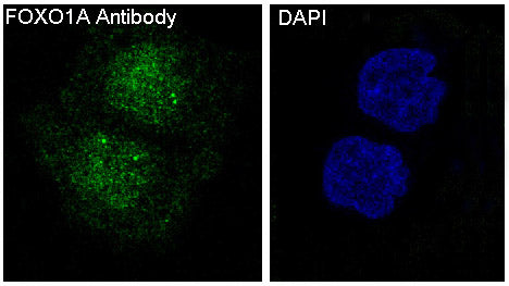 Anti-FOXO1 Rabbit Polyclonal Antibody