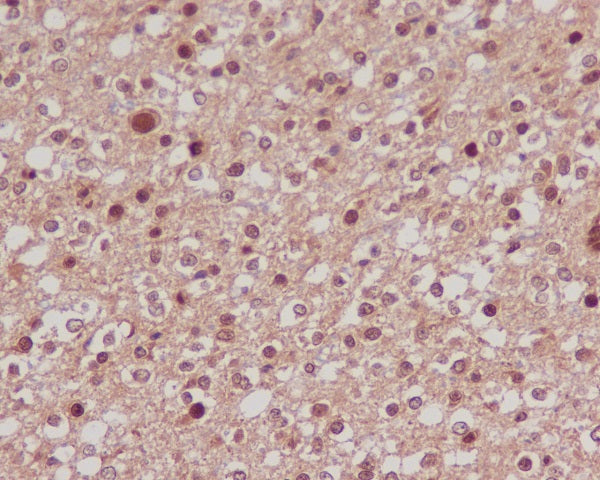 Anti-FOXO1 Rabbit Polyclonal Antibody