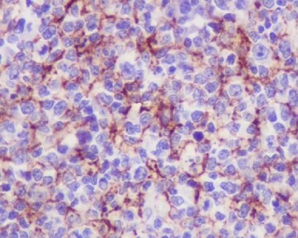 Anti-VCAM1 Rabbit Polyclonal Antibody