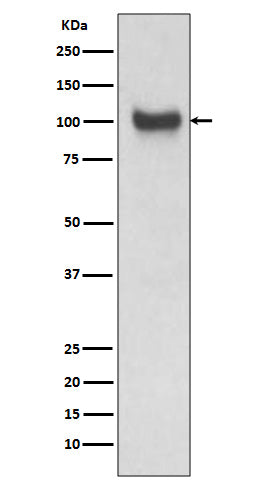 Anti-VCAM1 Rabbit Polyclonal Antibody