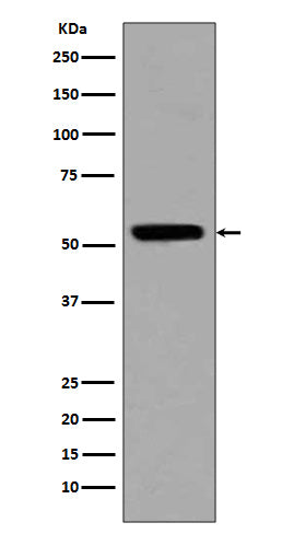 Anti-Acetyl-p53 (Lys370) Rabbit Polyclonal Antibody