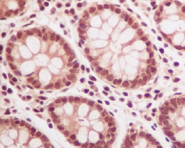Anti-Ubiquitin Rabbit Polyclonal Antibody
