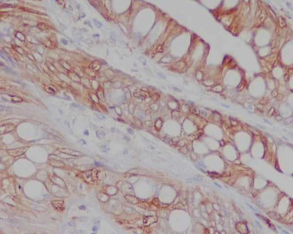 Anti-CD8 alpha Rabbit Polyclonal Antibody