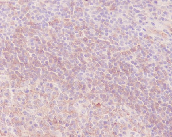 Anti-Human IgM Rabbit Polyclonal Antibody