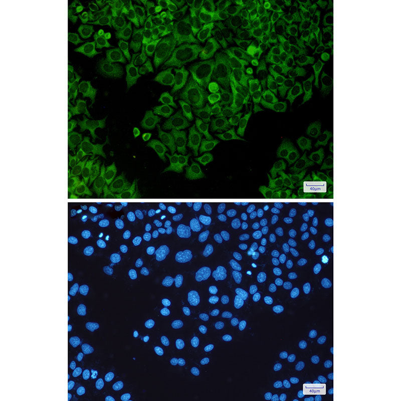 Anti-TNF Receptor 2 Rabbit Polyclonal Antibody