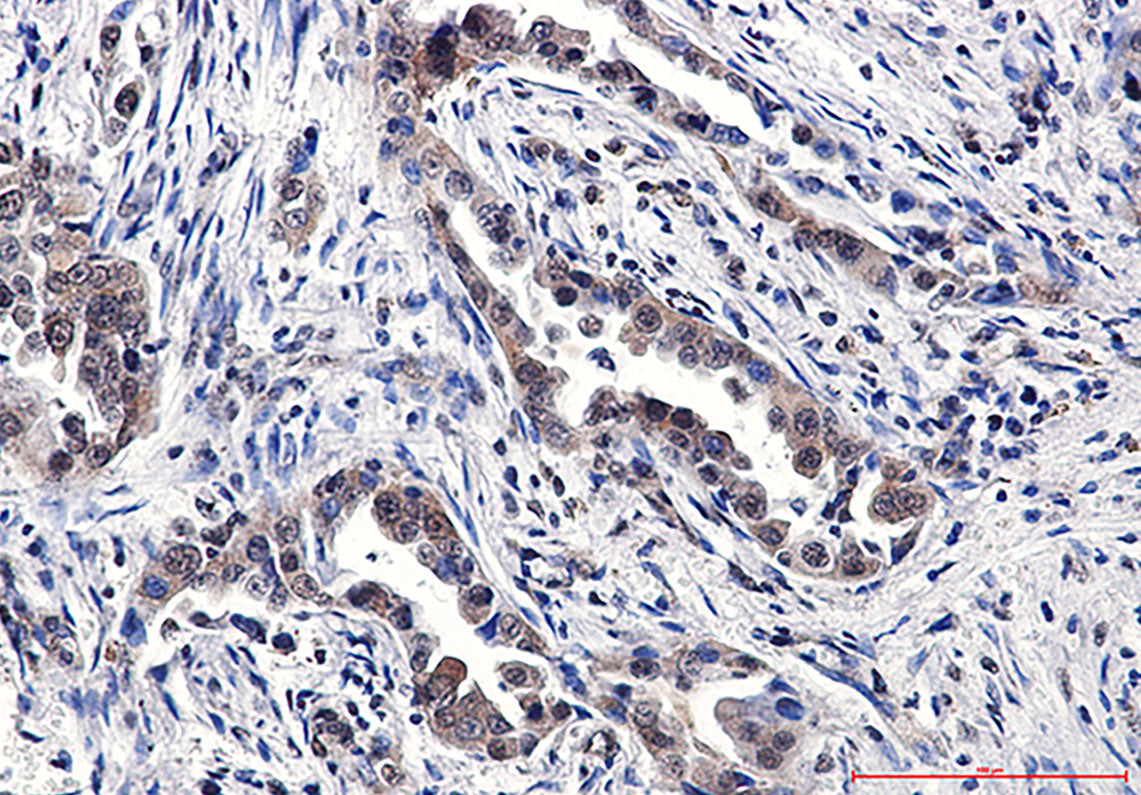 Anti-TNF Receptor 2 Rabbit Polyclonal Antibody