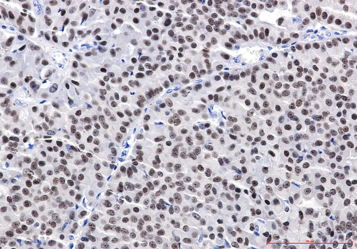 Anti-Estrogen Receptor alpha Rabbit Polyclonal Antibody