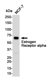 Anti-Estrogen Receptor alpha Rabbit Polyclonal Antibody