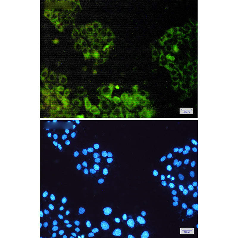 Anti-ATP6V1E1 Rabbit Polyclonal Antibody