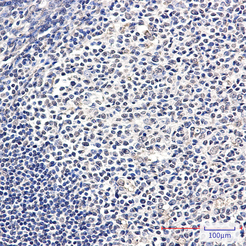 Anti-ATP6V1E1 Rabbit Polyclonal Antibody